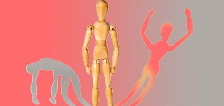 اختلال دوقطبی نوع دو